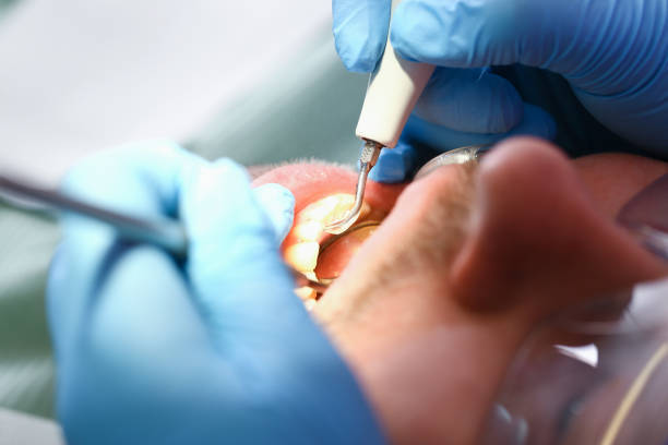 Best Emergency Tooth Extraction in Trion, GA