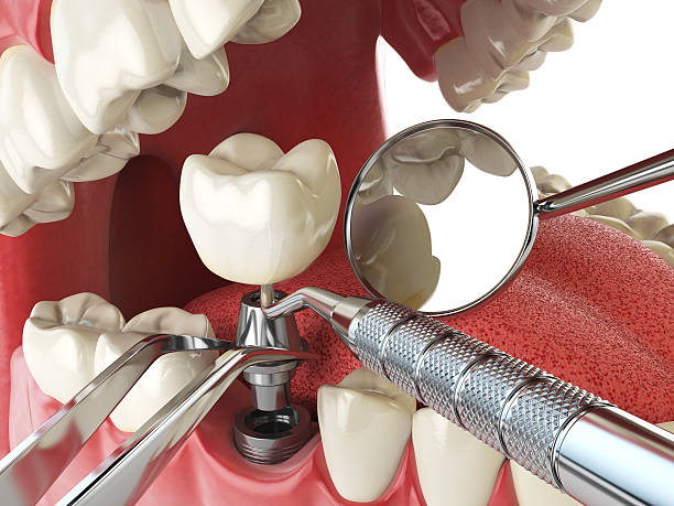Best Urgent Care for Lost Fillings or Crowns in Trion, GA